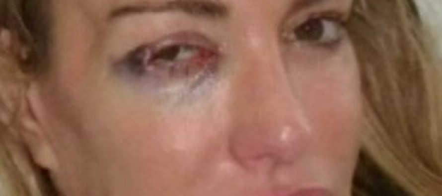 Taylor Armstrong Abuse Photos of Beverly Hills Housewife